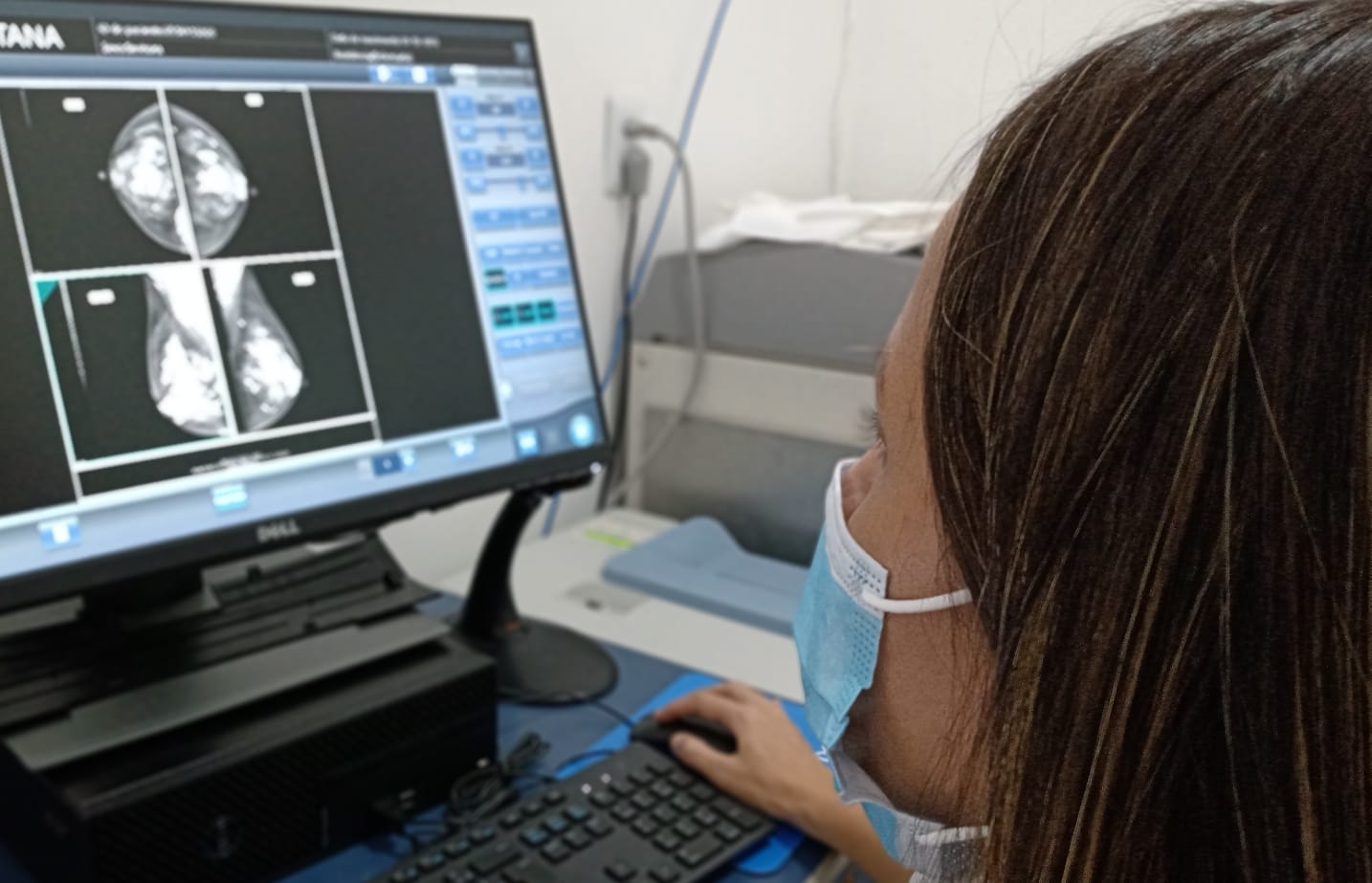 Após vacina contra Covid-19, Mulheres devem esperar 4 semanas para fazer mamografia